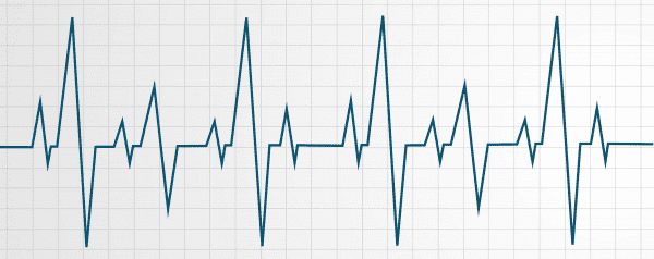 Heart Beat Chart